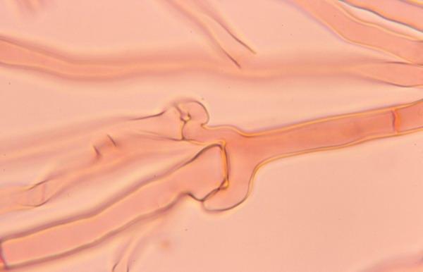 Foto microscopio de hifas con fíbulas